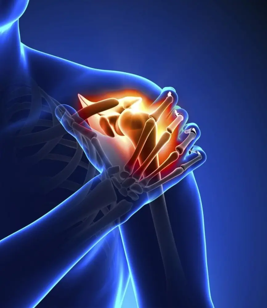 Illustration of shoulder pain and restricted movement